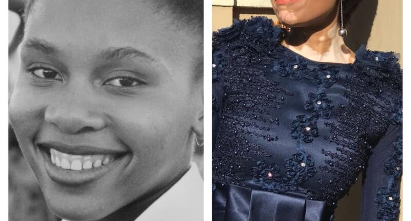 Is The Movie Sarafina Based On A True Story? What Happened To Actress Leleti Khumalo's Skin?