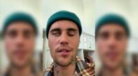 Justin Bieber Face Video: Reveals He Has Facial Paralysis Due To Ramsay Hunt Syndrome