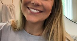 Shawn Johnson Plastic Surgery: Before And After Pictures - Here Is Why She Looks So Different Now