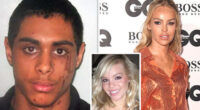 What's Happened To Katie Piper's Face? Where Is She Now
