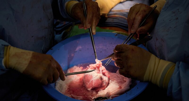 NY researchers transplant pig hearts into 2 brain dead patients