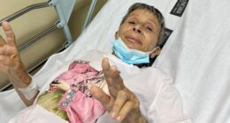 Sticky Vicky Accident: How Did It Happen? Update On Her Knee Injury After The Horrific Accident