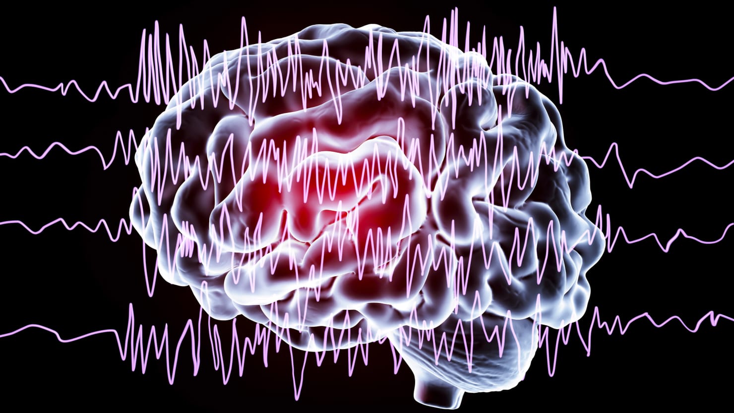 algorithms-that-detect-brain-s-hidden-consciousness-can-help-doctors