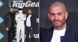 Why Did Top Gear Cast Chris Harris Have No Hair?
