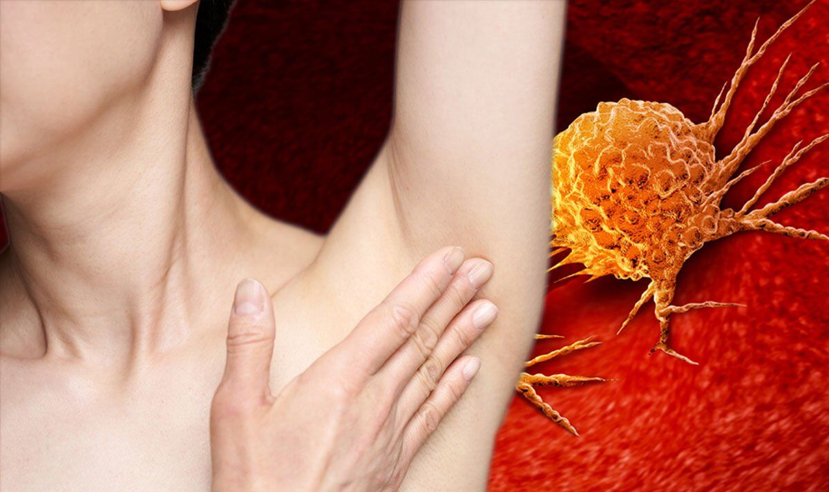 cancer-symptoms-of-skin-cancer-may-include-lumps-under-the-armpit