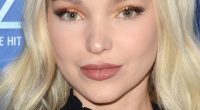 Plastic Surgery: Has Dove Cameron Done Botox? Fans Suspect Lip Filler And Cheekbone Uplift