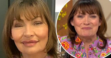 Marlo Thomas Botox - Did She Have A Facelift? Her Before And After Photos