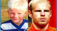 Davy Klaassen Hair: Does The Player Have Alopecia Or Albinism?