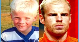 Davy Klaassen Hair: Does The Player Have Alopecia Or Albinism?
