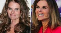 Did Maria Shriver Had Face Lift Surgery? Before And After Photos
