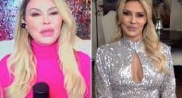 RHOBH: What Happened To Brandi Glanvilles Face, Is She Pregnant In 2022? Scar Explained