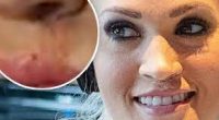 Fact Check: Did Carrie Underwood Get Her Lips Done? Plastic Surgery Before And After