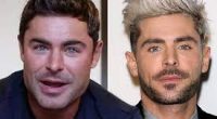 Fact Check: Did Zac Efron Undergo Plastic Surgery? How Does He Look Like Now in 2022?