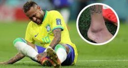 Injury Update: Does Neymar Jr Have Swollen Ankle: Is He Out of World Cup Or Will Be Playing Next Game?