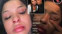 What Did Chrisean Rock Do To Her Face? A Look At Her Before Fame Photos