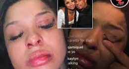 What Did Chrisean Rock Do To Her Face? A Look At Her Before Fame Photos