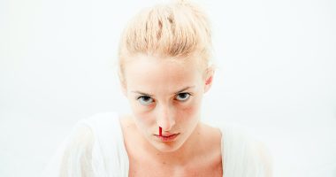 Is Nosebleeding Dangerous To One's Health? Causes And How to stop a nosebleed