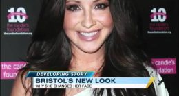 Did Sarah Palin Do Face Corrective Surgery? Her Before And After Photos