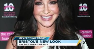 Did Sarah Palin Do Face Corrective Surgery? Her Before And After Photos