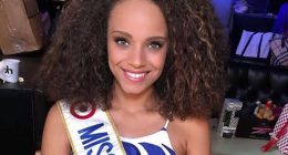 Alicia Aylies Before Surgery: How Did She Look Like? Net Worth And Family