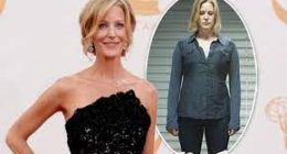 Illness: Is Apology Cast Anna Gunn Sick? Health Update - Was She Diagnosed With Systemic Lupus Erythematosus