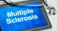 Cost of Living With Multiple Sclerosis: How Much Does MS Treatment Cost?