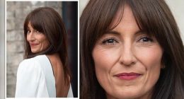 Illness: What Is Wrong With Davina Mccall Face? Plastic Surgery Before And After
