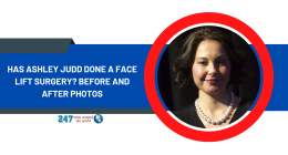 Has Ashley Judd Done A Face Lift Surgery? Before And After Photos