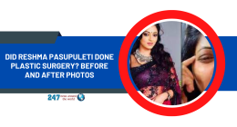 Did Reshma Pasupuleti Done Plastic Surgery? Before And After Photos
