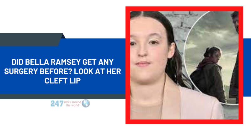 Did Bella Ramsey Get Any Surgery Before? Look At Her Cleft Lip