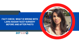Fact Check: What Is Wrong With Lama Hasan Face? Surgery Before And After Photo