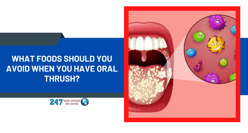 What foods should you avoid when you have oral thrush?