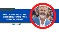 What Happened To Mel Gibson Mouth? His Face Surgery Update