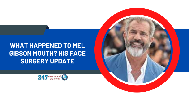 What Happened To Mel Gibson Mouth? His Face Surgery Update