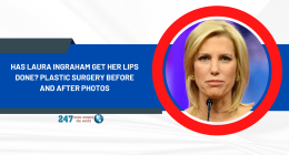 Has Laura Ingraham Get Her Lips Done? Plastic Surgery Before And After Photos