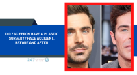Did Zac Efron Have A Plastic Surgery? Face Accident, Before And After