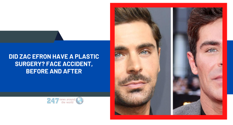 Did Zac Efron Have A Plastic Surgery? Face Accident, Before And After