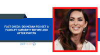 Fact Check: Did Megan Fox Get A Facelift Surgery? Before And After Photos