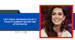 Fact Check: Did Megan Fox Get A Facelift Surgery? Before And After Photos