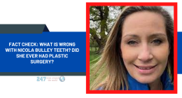 Fact Check: What Is Wrong With Nicola Bulley Teeth? Did She Ever Had Plastic Surgery?