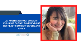 Lai Austria Without Surgery: Who Is She Dating? Boyfriend And Her Plastic Surgery Before And After