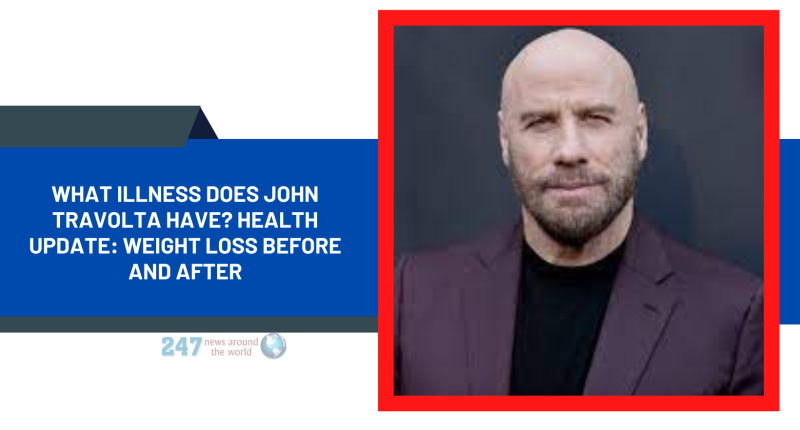 What Illness Does John Travolta Have? Health Update: Weight Loss Before And After