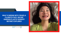 What Is Wrong With Yskaela Fujimoto Face: Did She Undergo Plastic Surgery Before? Explored