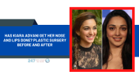 Has Kiara Advani Get Her Nose And Lips Done? Plastic Surgery Before And After