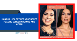 Has Dua Lipa Get Her Nose Done? Plastic Surgery Before And After