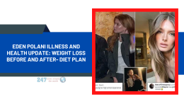 Eden Polani Illness And Health Update: Weight Loss Before And After- Diet Plan