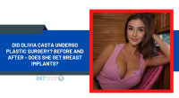 Did Olivia Casta Undergo Plastic Surgery? Before And After – Does She Get Breast Implants?
