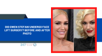 Did Gwen Stefani Undergo Face Lift Surgery? Before And After Photo