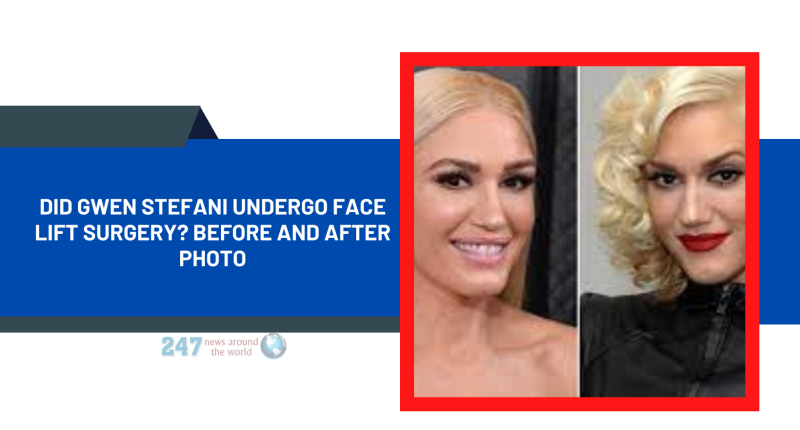 Did Gwen Stefani Undergo Face Lift Surgery? Before And After Photo