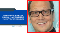 Did Actor Rob Schneider Undergo Plastic Surgery? Facelift Rumor Explained